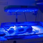 A neonate is receiving jaundice treatment using the Brilliance Pro 