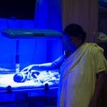 A neonate is receiving jaundice treatment using the Brilliance Pro
